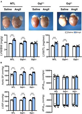 Cardiac Gq Receptors and Calcineurin Activation Are Not Required for the Hypertrophic Response to Mechanical Left Ventricular Pressure Overload